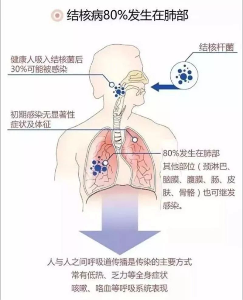 肺结核最新动态，心灵与自然的交织之旅